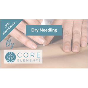 Image of Dry Needling Treatment